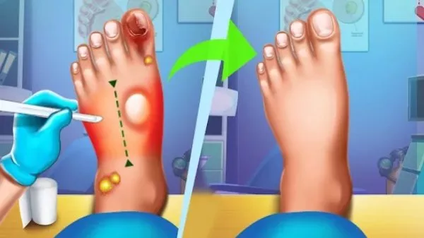 Gameplay screenshot from foot surgery doctor care offline doctor games for Android