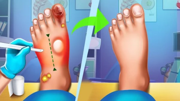 cirurgia do pé atendimento médico off-line jogos de médico MOD APK Android